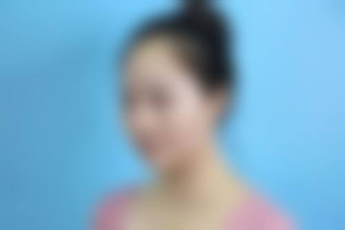 四、陕西榆林初妍盛开整形医院实例