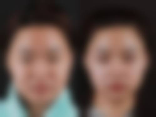 八、韩国赫拉整形医院真实的顾客评价如下：