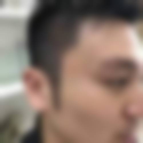 七、重庆春草世纪植发医院真实的顾客评价如下：