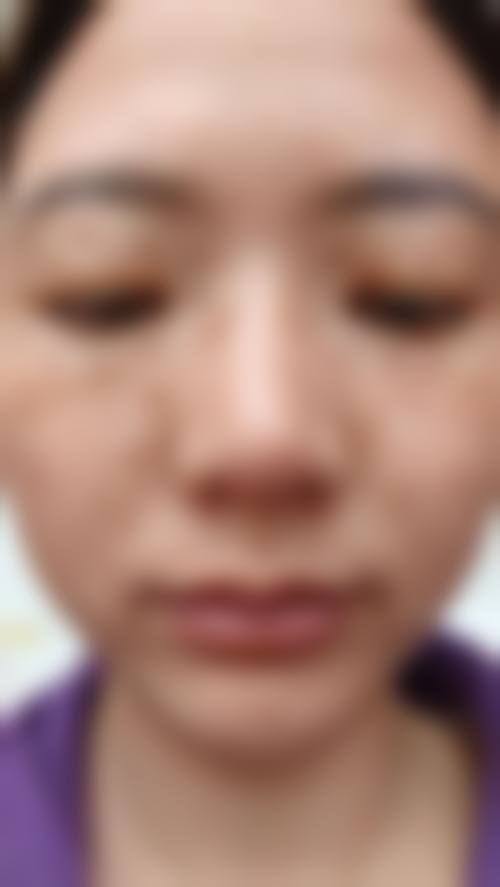 四、拉本整形外科开展的主要项目和特色项目