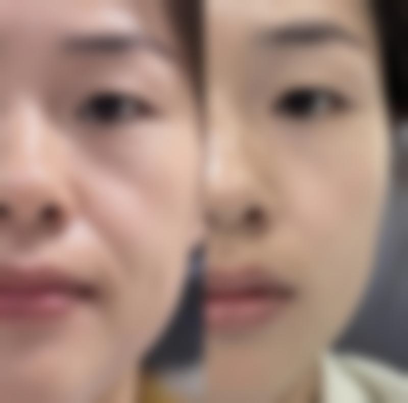 火龙果去眼袋是真的吗？揭秘其抗氧化成分与食用外敷法对改善眼袋的神奇作用 