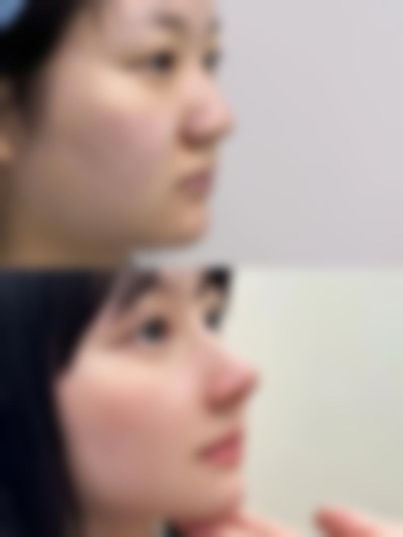七、韩国赫拉整形医院价格表：（仅供参考）