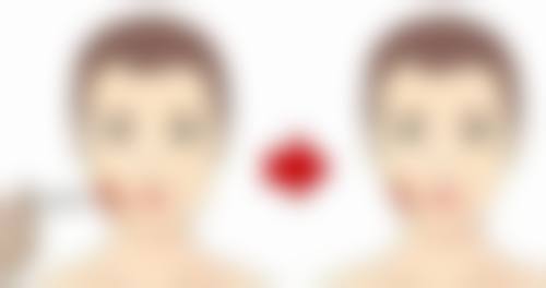 双眼皮术后3个月能否修复？揭秘不同情况修复可行性，3个月修复优势与关键点 