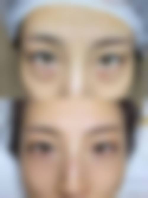 八、广州广美整形美容门诊部真实的顾客评价如下：