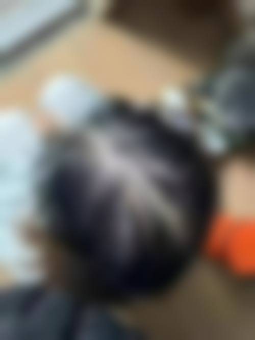 八、湖南笙泽医疗美容诊所植发真实的顾客评价如下：
