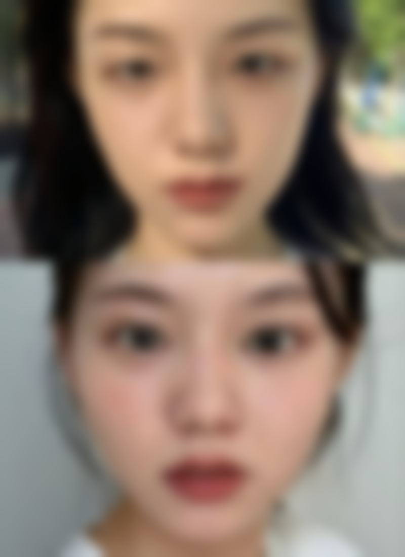 六、潍城华美创和医疗美容医院怎么预约：