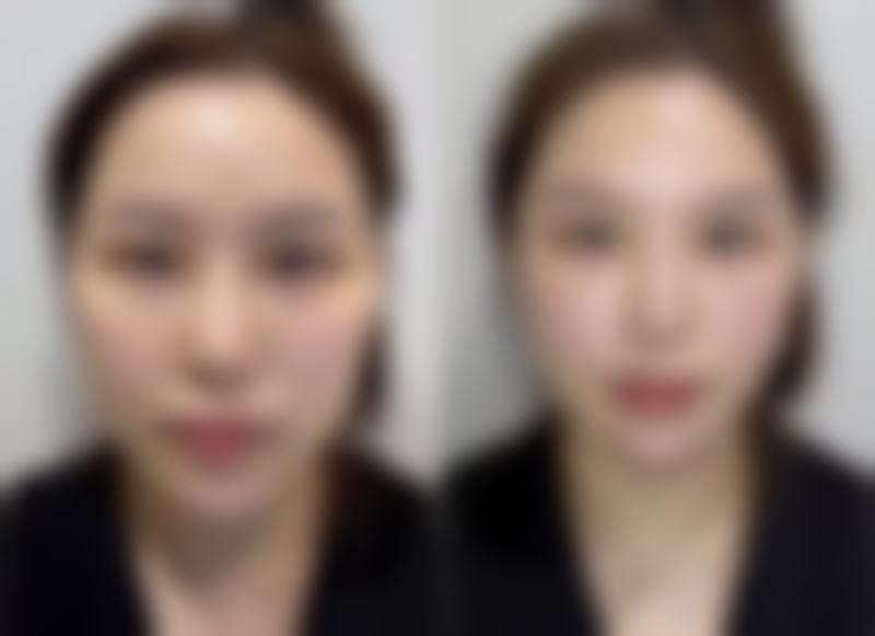 方一鸣医生实例