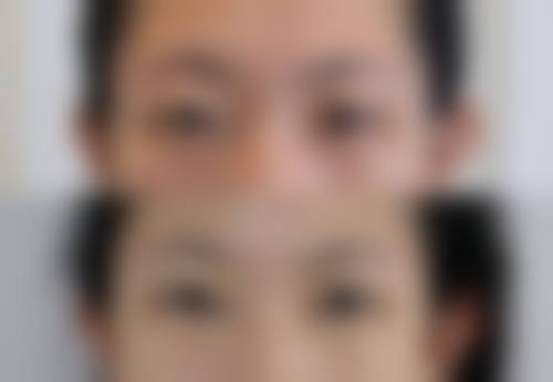 七、南昌爱贝思整形美容医院价格表：（仅供参考）