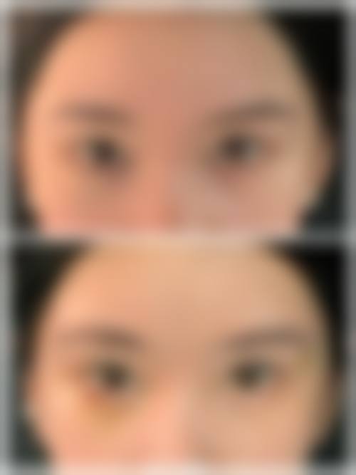 六、南昌爱贝思整形美容医院怎么预约：