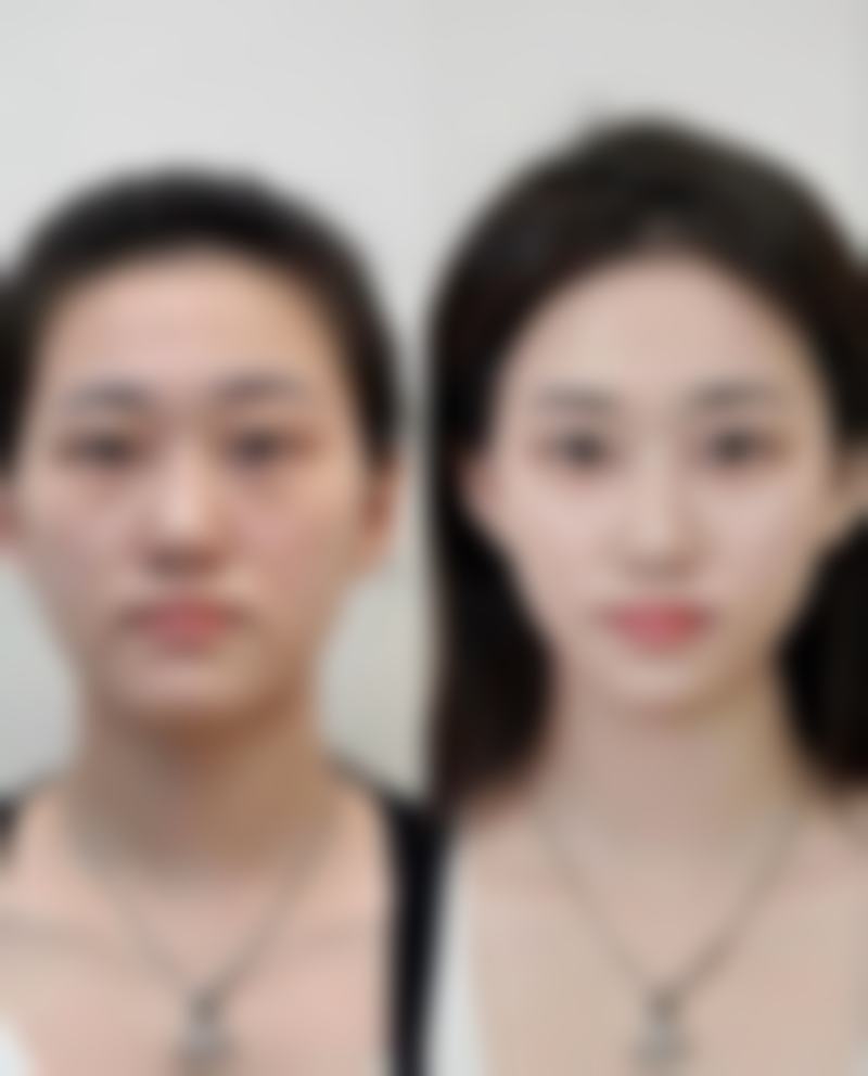 五、永康卢莹医疗美容诊所实例