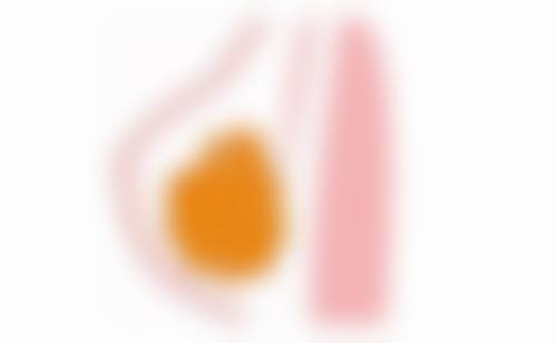 骨粉隆鼻的定义与操作特点:轻松塑造美鼻