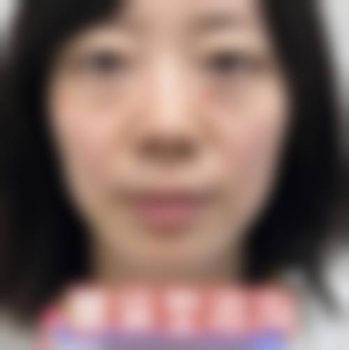 五、如皋超妍医疗美容诊所实例
