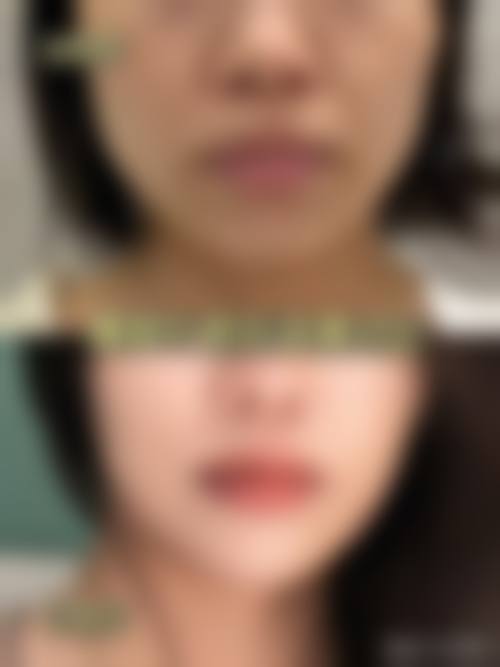丁月医生在哪家医院怎么预约？