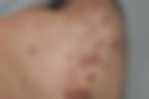 三、南通第三人民医院烧伤整形外科医生介绍: