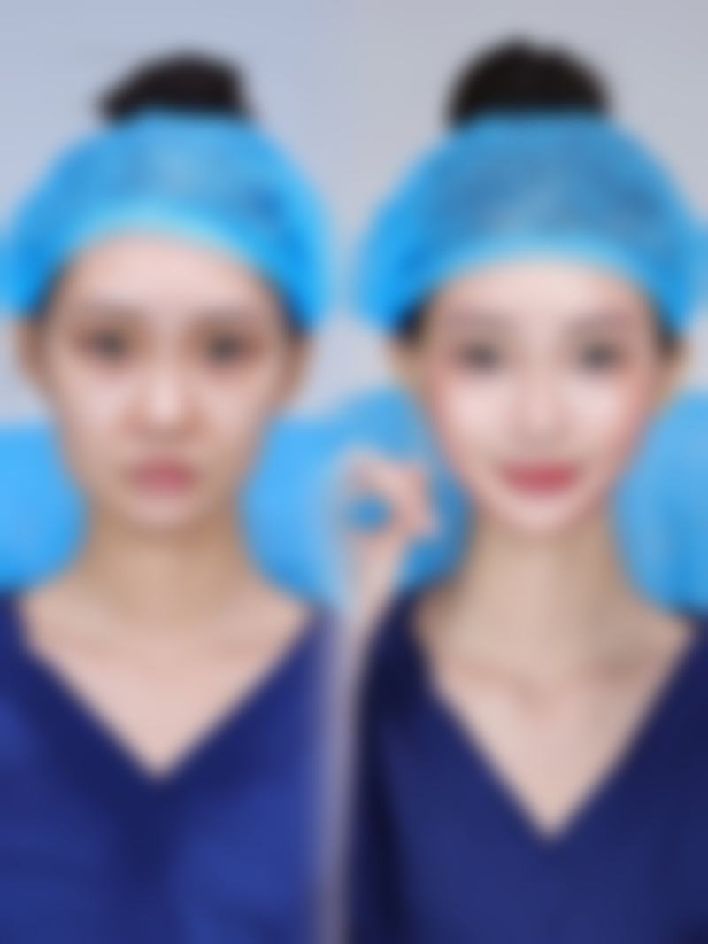 七、如皋超妍医疗美容诊所价格表：（仅供参考）