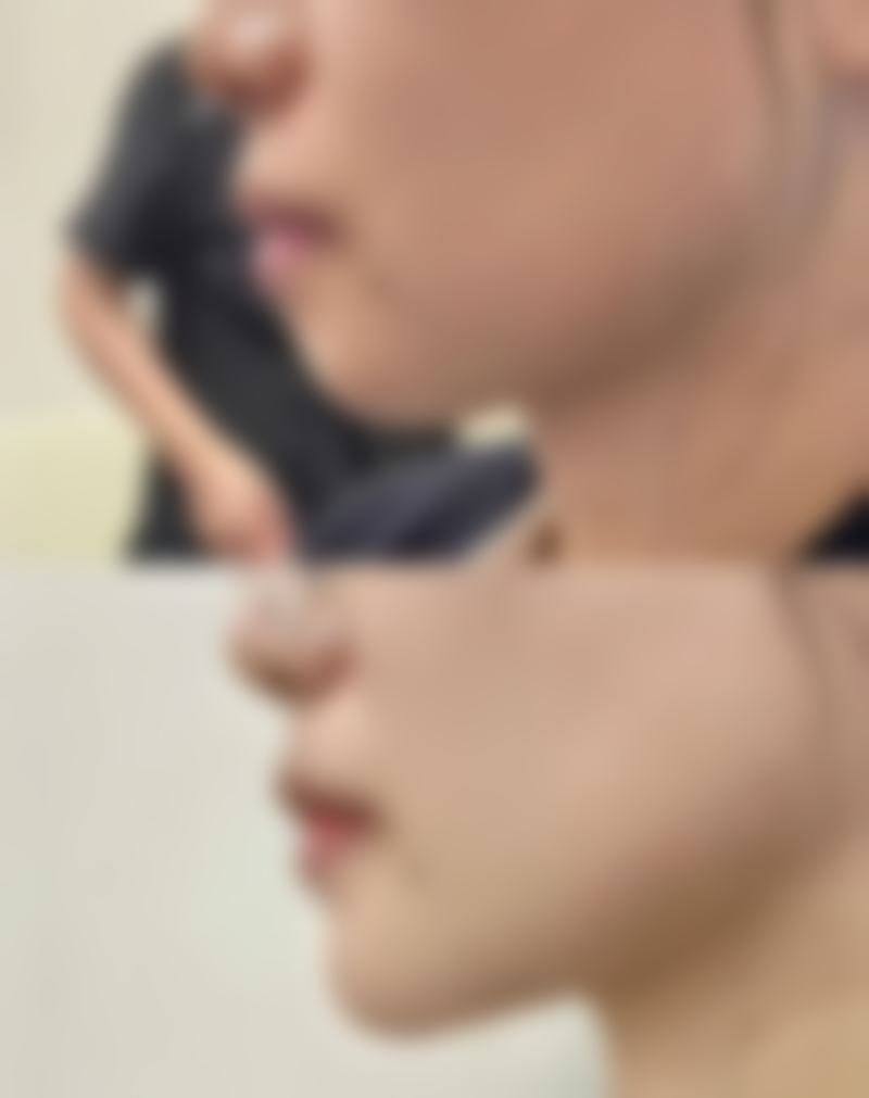 丁月医生实例