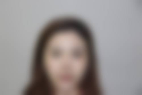 五、沈阳王衍整形医疗美容诊所实例