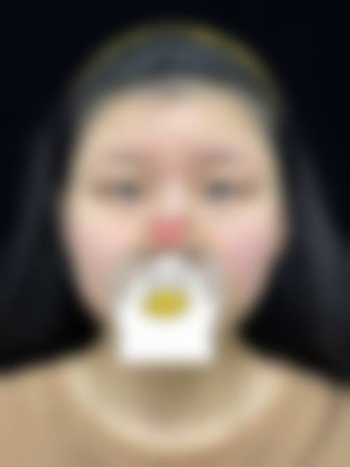 柳锡泰医生实例