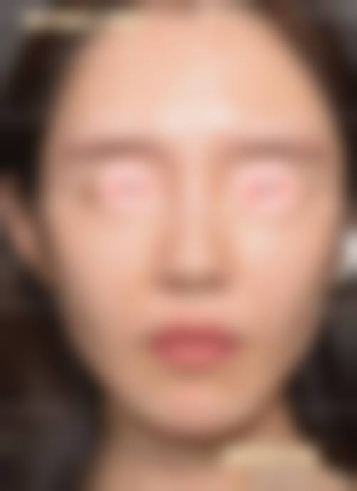 柳锡泰医生在哪家医院怎么预约？