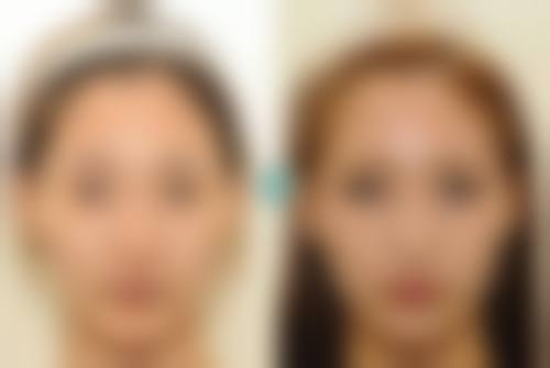 八、昆明市华美整形美容医院真实的顾客评价如下：