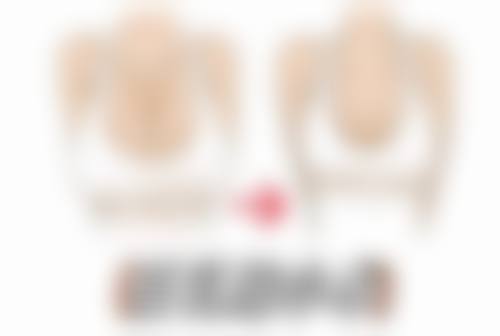 怎样效率高搞定眼袋？物理治疗显神通
