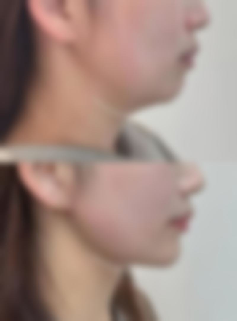 八、海口星之美医疗美容医院真实的顾客评价如下：