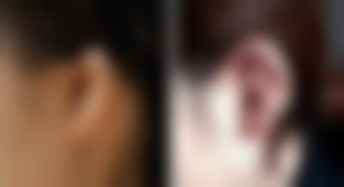 顾青医生口碑和评价