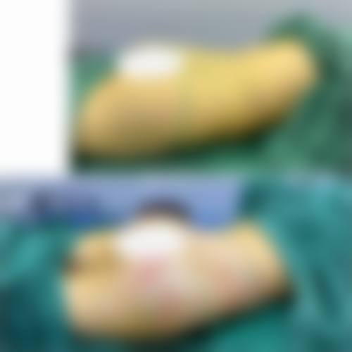 七、重庆张瑜整形医疗美容真实的顾客评价如下：