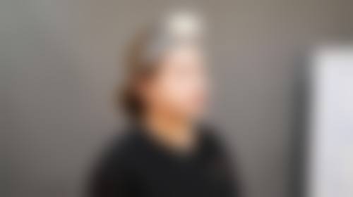 七、沈阳孙兵整形医院价格表：（仅供参考）