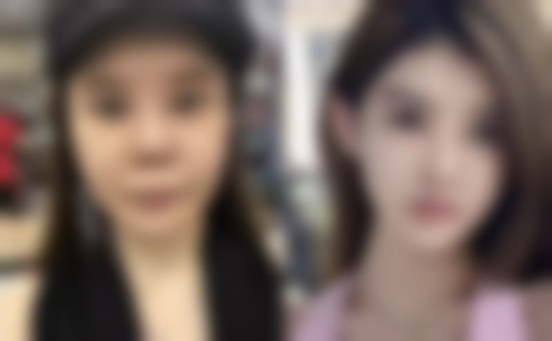 术后疤痕修复用啥妙?揭秘洋葱提取物产品,新生肌肤有门道