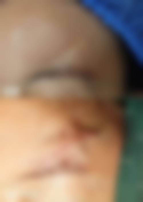 袁定芬医生在哪家医院怎么预约？