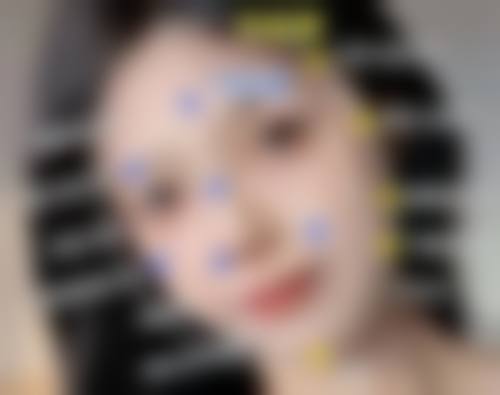 双眼皮术后何时涂祛疤膏更有效?晚期涂抹的巩固抗疤成果