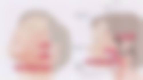 老年人割眼袋:临床实例与专精建议