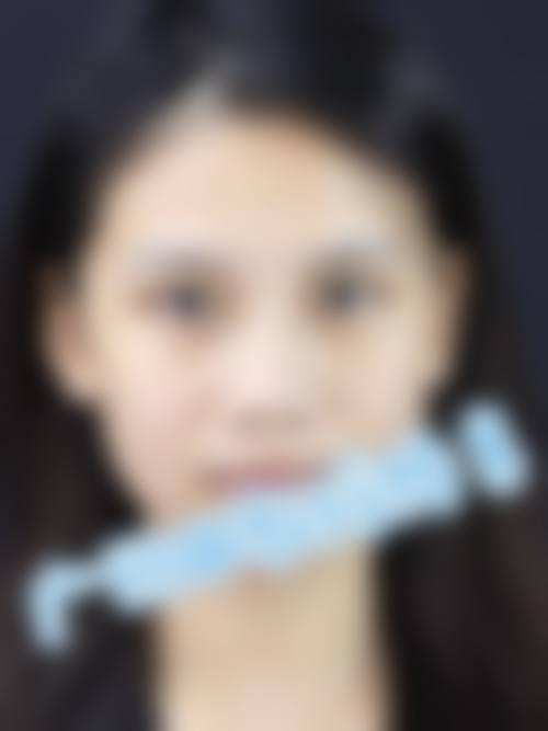 七、武汉珍妮整形医院价格表：（仅供参考）