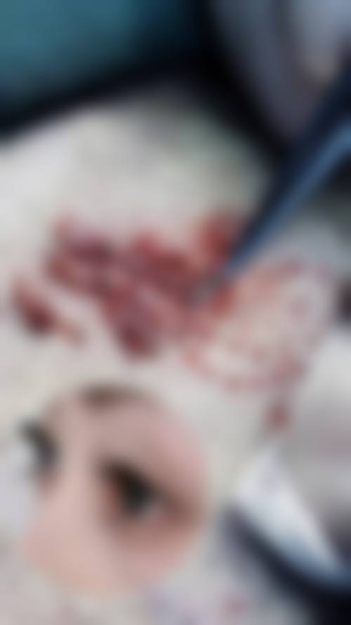 权五晟医生在哪家医院怎么预约？