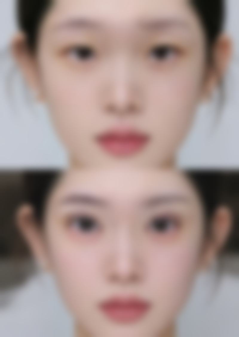 六、西安西子梦医疗美容诊所价格表：（仅供参考）