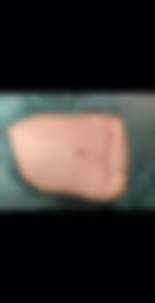 七、韩国首尔slim整形医院价格表：（仅供参考）