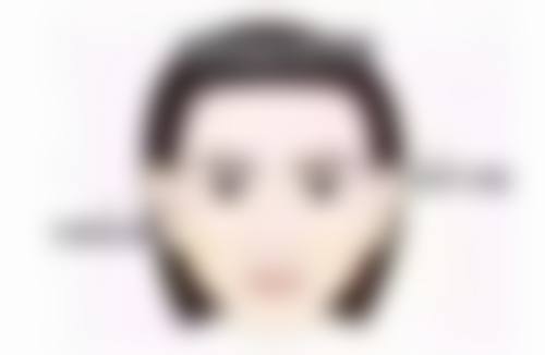 25岁做眼袋手术后,注意这些事项