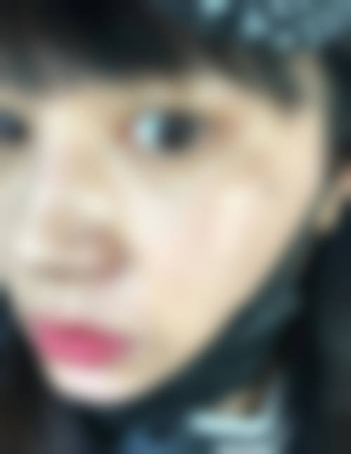 姜雪梅医生实例