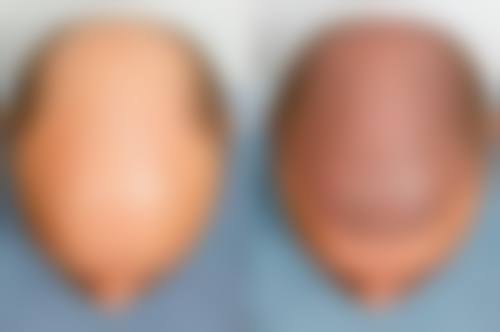 五、东莞康华医院整形美容中 心实例