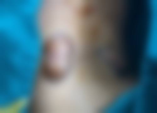 术后通用注意事项不能忘