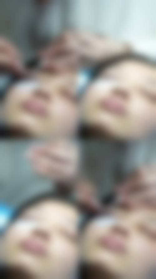 四、沈阳睿漾整形医院实例