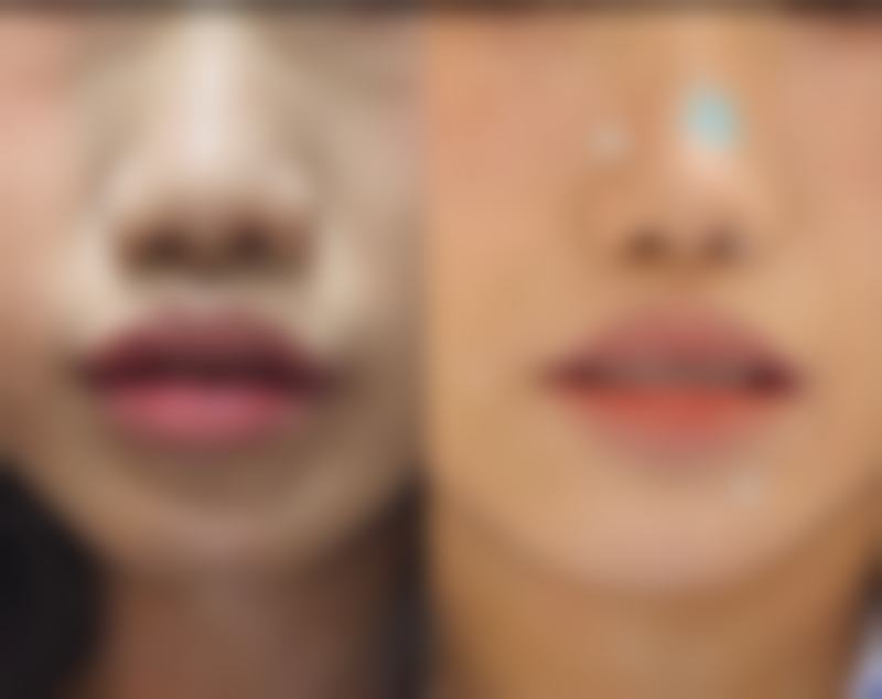 七、韩国now美整形医院价格表：（仅供参考）