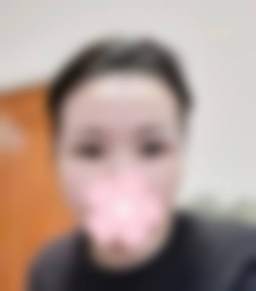 八、新疆华莉丝医疗美容门诊部真实的顾客评价如下：