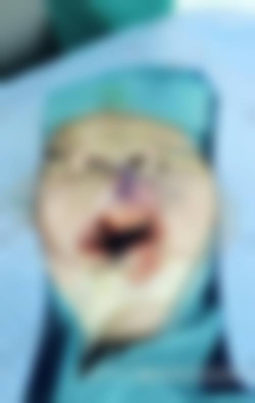 王康远医生在哪家医院怎么预约？