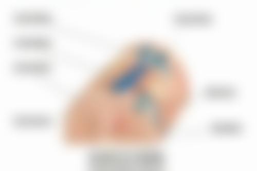 眉毛缺损/瘢痕的补救方式