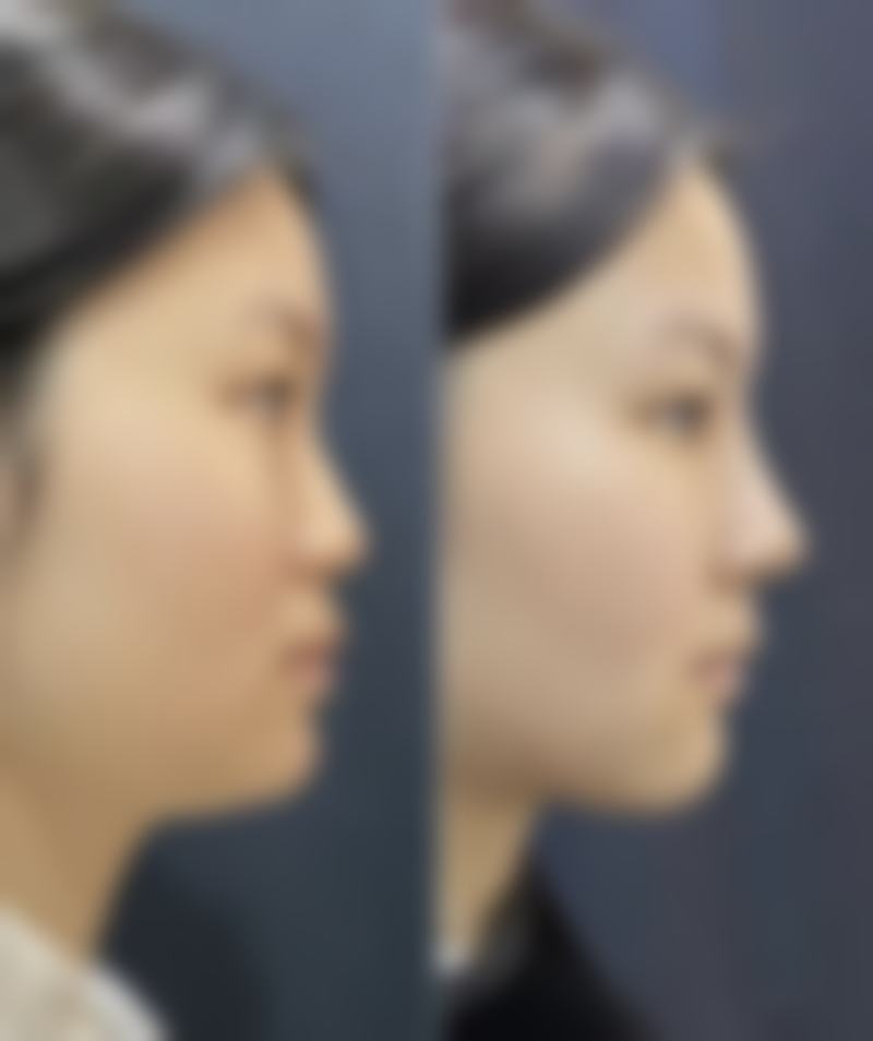 七、广州艾唯整形美容门诊部真实的顾客评价如下：