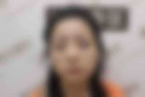 五、常德文氏名媛整形医院实例