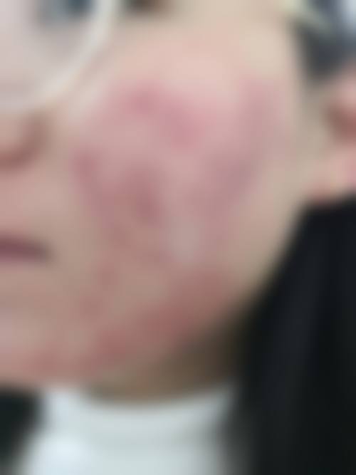 王彩霞医生在哪家医院怎么预约？