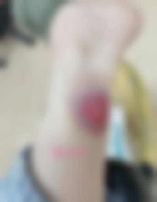 六、兰州中泰激光整形美容医院怎么预约：